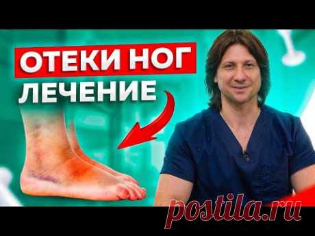 Что делать, если отекают ноги? 5 причин и способы лечения отека ног