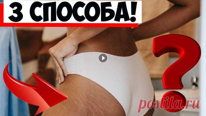 Профилактика растяжек: 3 способа улучшить эластичность кожи! Профилактика растяжек: 3 способа улучшить эластичность кожи! Больше интересного на канале "СЕКРЕТЫ ДОМОХОЗЯЕК": Самые популярные видео:...