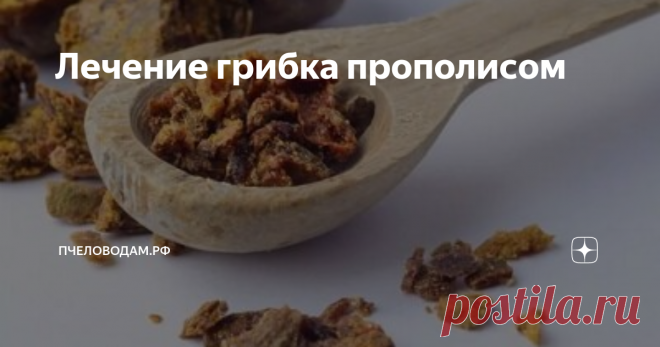 Лечение грибка прополисом Прополис - природный продукт, обогащённый минералами и витаминами. По сути, это клей, которым пчёлы заделывают щели в ульях, перекрывают вход, закрывают соты, дезинфицируют ячейки, обволакивают посторонние предметы.