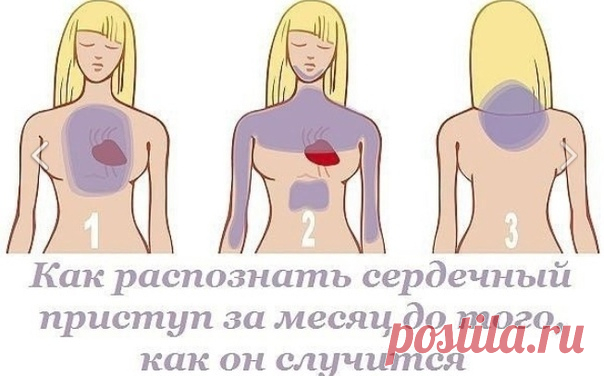 Симптомы сердечного приступа

Знаете ли вы, что основной причиной досрочной смерти в современном мире является сердечный приступ!? Но сегодня я расскажу вам, как распознать сердечный приступ за месяц до того, как он случится. Главное - наблюдательность!

Напряженный образ жизни, привычка есть нездоровую еду, хронические недосыпы... Мы сами вносим большой вклад в развитие недуга, который с каждым годом становится все более распространенным и все более опасным.
Показать полностью...