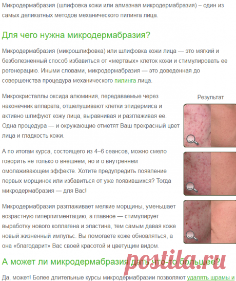 Микродермабразия / Шлифовка лица и кожи (отзывы и цены) — Дермабразия и микродермабразия (стоимость)