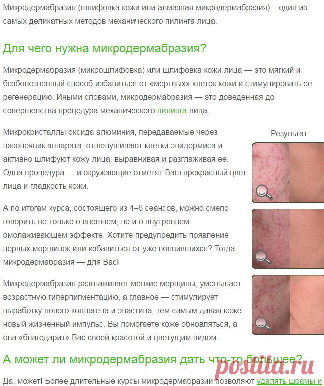 Микродермабразия / Шлифовка лица и кожи (отзывы и цены) — Дермабразия и микродермабразия (стоимость)