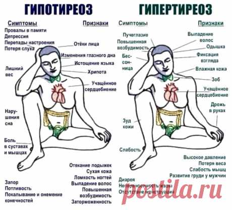 Гипотиреоз и гипертиреоз (симптомы и признаки)