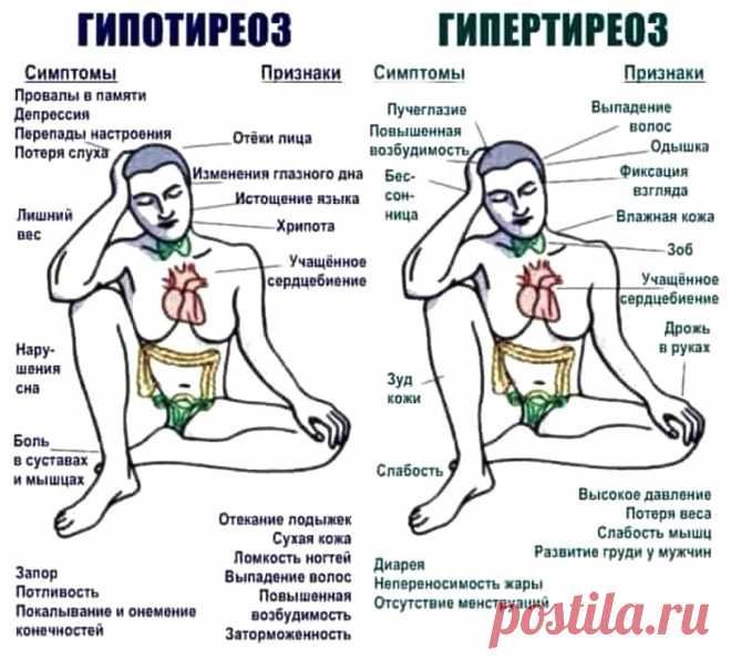 Гипотиреоз и гипертиреоз (симптомы и признаки)