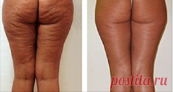 Lo que ella se unta en el trasero, todos lo tienen en casa, ¡pero nadie lo usa! – Hoy En Belleza de Bella Y Belleza
Просматривайте этот и другие пины на доске Best of пользователя Elena.
Теги
Lo que ella una se unita en el trascero, todo lo tienes en casa y todavía no usa!
¡Hoy en Belleza y Bellezas!
Просматривайте этот и другие пины на доске Ladies пользователя Linda Marie.
Теги
Что говорят другие
Gallery of House / Katerina Dyagileva - 21
The House is a contemporary house designed …