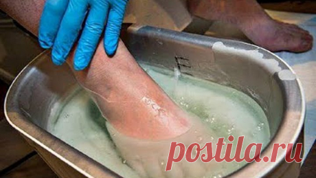 Грибок Отсохнет с Корнем! Возьми да намажь ноги обыкновенной…