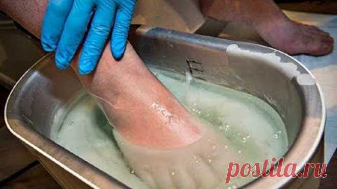 Грибок Отсохнет с Корнем! Возьми да намажь ноги обыкновенной…