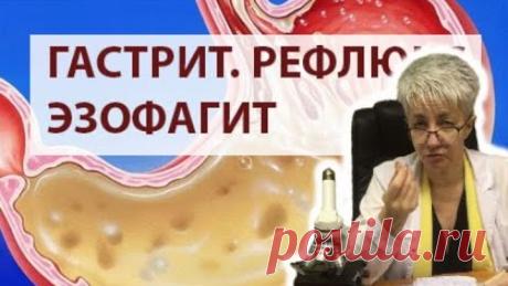 ГАСТРИТ. РЕФЛЮКС. ЭЗОФАГИТ. ХЕЛИКОБАКТЕРИ. ХОЛЕЦИСТИТ. Бублик Наталья Николаевна 8(950)0330055