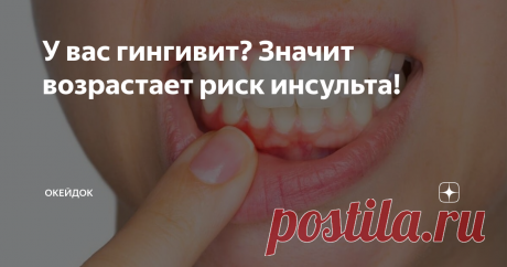 У вас гингивит? Значит возрастает риск инсульта! Сегодня многие страдают от заболеваний десен, но не придают этому особого значения. А зря. Поскольку это не просто «неудобства», а серьезная проблема, способная спровоцировать ряд еще более серьезных.
Совсем недавно в этой области было проведено несколько интересных исследований, результаты которых убедительно доказали: заболевания десен (гингивит, в частности) связаны с повышением риска развития