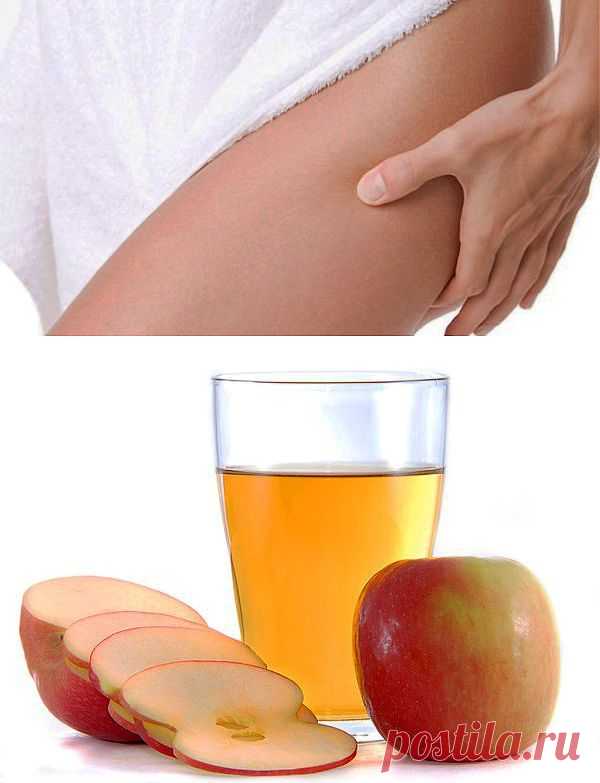 Яблочный уксус от растяжек. Идеальное тело в домашних условиях - Женский журнал LadySpecial.ru