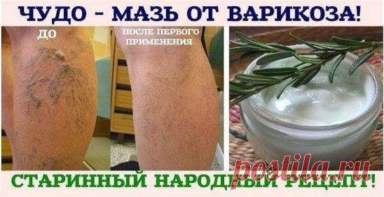 Сохраните, чтобы не потерять!
Девочки, я хоть и медик, но тут столкнулась с проблемой. У моей мамы жуткий варикоз. И врачи сказали - только операция. А она - ни в какую. Искали способы, покупали мази дорогущие, ничего не помогало. Но как-то мне одна знакомая рассказала про мазь, которая вылечила ей ноги!
У нее также был варикоз, и в последнее время даже язвочки на ногах, темные пятна.
Хирурги сказали, что необходимо делать операцию, иначе... сама не справится!
И вот, помогла ей такая мазь, д
