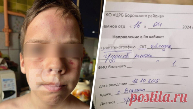Двое россиян жестоко избили ребенка-инвалида с эпилепсией и собаку. В Калужской области двоих мужчин обвинили в жестоком избиении ребенка-инвалида с эпилепсией и собаки. Об этом сообщает Telegram-канал ES!. По информации Telegram-канала, инцидент произошел в селе Ворсино. По словам матери 9-летнего ...