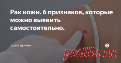 Рак кожи. 6 признаков, которые можно выявить самостоятельно. Уделите внимание осмотру поверхности своей кожи, это может помочь сохранить здоровье и даже жизнь.