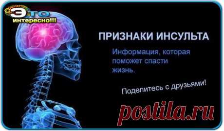 Инсульт! Симптомы, первая помощь и виды реабилитации (Это НАДО знать!) » Женский Мир