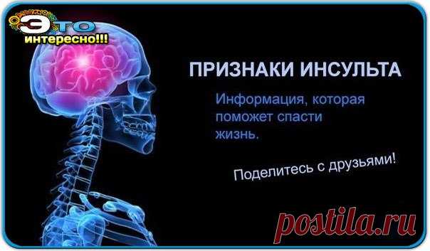 Инсульт! Симптомы, первая помощь и виды реабилитации (Это НАДО знать!) » Женский Мир