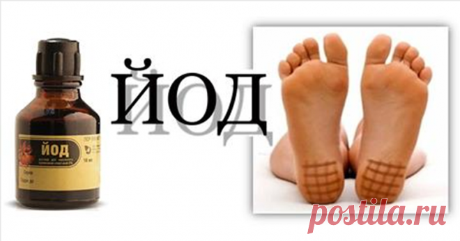 Йодная сетка избавит от 20 заболеваний! Узнайте о целебной силе простых линий!