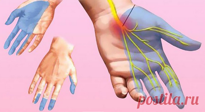 Почему немеют руки во сне Когда мы крепко спим ночью, то долго находимся в одной позе. В результате может онеметь рука...