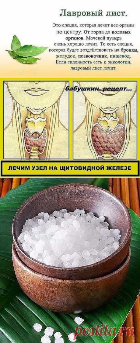 ЛАВР