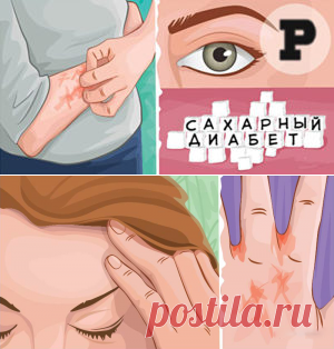 9 симптомов высокого уровня сахара, которые нельзя игнорировать