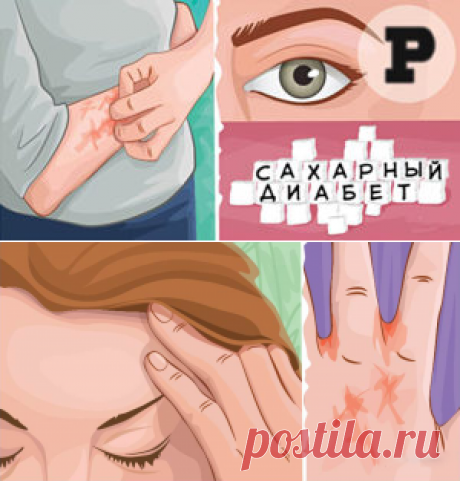 9 симптомов высокого уровня сахара, которые нельзя игнорировать