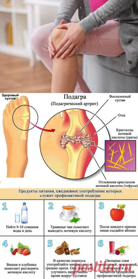 Мои показатели мочевой кислоты оказались повышенными: рассказываю о рекомендациях от лечащего врача | Блоггерство на пенсии | Яндекс Дзен