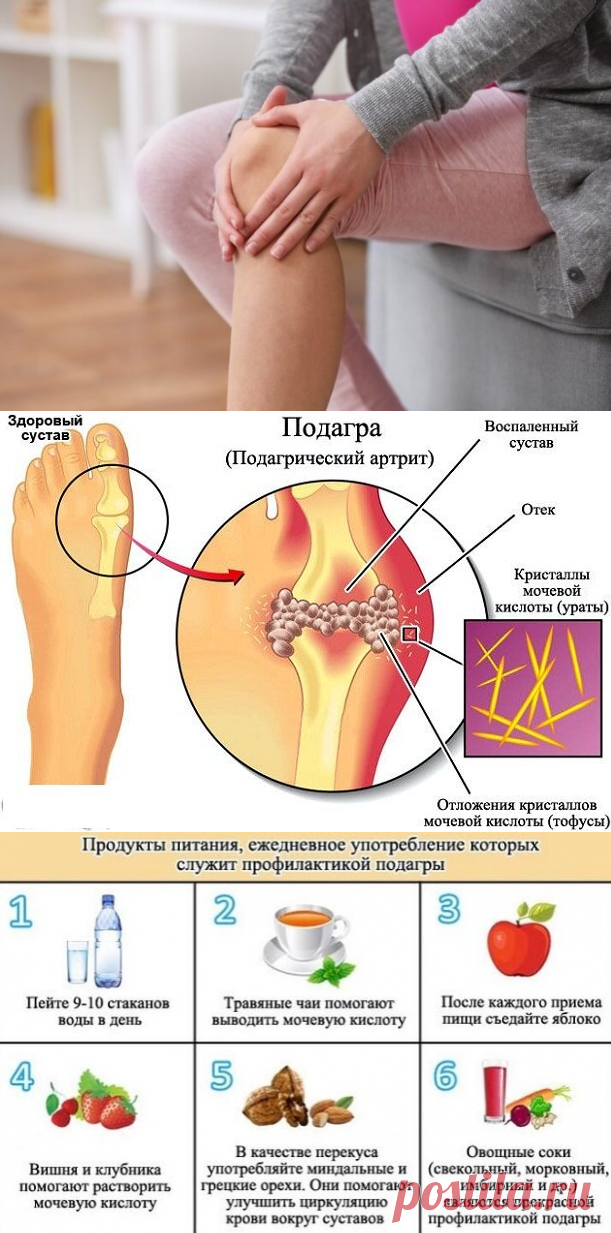 Мои показатели мочевой кислоты оказались повышенными: рассказываю о рекомендациях от лечащего врача | Блоггерство на пенсии | Яндекс Дзен