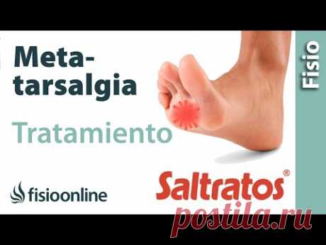 Ejercicios, estiramientos y masaje para tratar la metatarsalgia