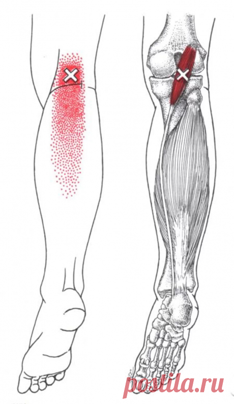 Подошвенная мышца. Самомассаж