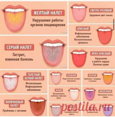 Ваш язык расскажет о проблемах со здоровьем первым делом!