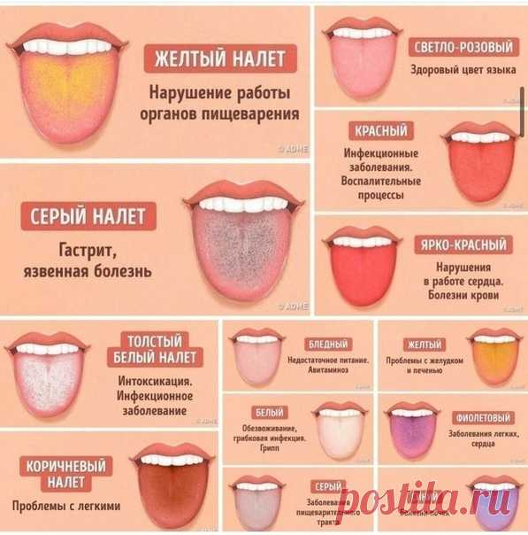 Ваш язык расскажет о проблемах со здоровьем первым делом!