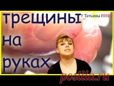 У Вас трескается КОЖА на руках и ногах - тогда мы идем к Вам!!!