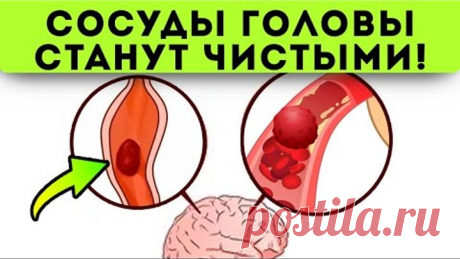 Смотрите, что делают старые врачи для чистки сосудов головы! Сосуды головы чистят...