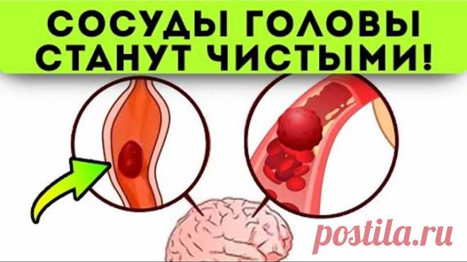 Смотрите, что делают старые врачи для чистки сосудов головы! Сосуды головы чистят...