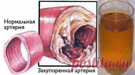 Очистите кровеносные сосуды с помощью всего одного стакана этого напитка! Рецепт стоит запомнить!