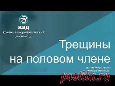 Трещины на головке и коже полового члена