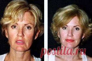 Главная – Фитнес для лица - Уникальная методика по омолаживанию кожи лица