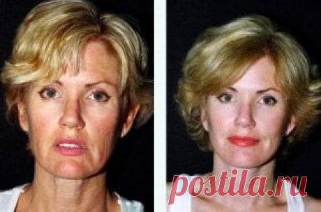 Главная – Фитнес для лица - Уникальная методика по омолаживанию кожи лица