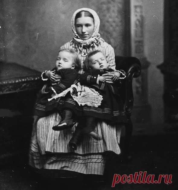 Беременность на двоих: история сиамских близнецов, одна из которых стала мамой | Мел