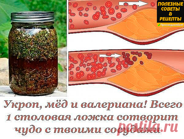 Укроп, мёд и валериана! Всего 1 столовая ложка сотворит чудо с твоими сосудами.