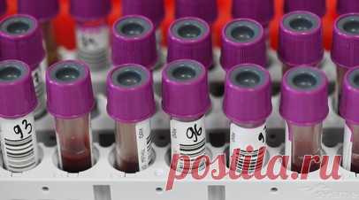 Минздрав: за 10 лет заболеваемость диабетом I типа в России выросла почти в два раза. Показатель заболеваемости диабетом I типа среди населения России за последнее десятилетие увеличился практически в два раза, сообщила директор РДКБ, главный внештатный специалист детский эндокринолог Минздрава России по ЦФО Елена Петряйкина. Читать далее