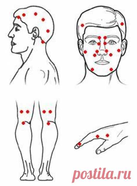 (33) Pinterest