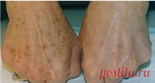 Одноклассники