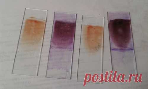 Записки лаборанта. Общий анализ крови: лейкоциты и СРБ   Врач-лаборант Кузняк Ирина: 