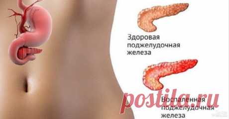 ЕСЛИ БЕСПОКОИТ ПОДЖЕЛУДОЧНАЯ ЖЕЛЕЗА, ТО НУЖНО…
