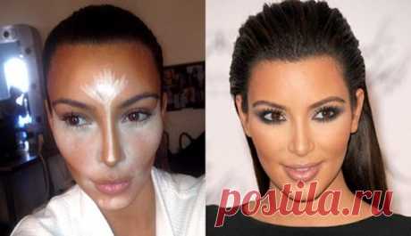 Коррекция скул в Киеве: цена, лицензия МОЗ - Coolaser Clinic