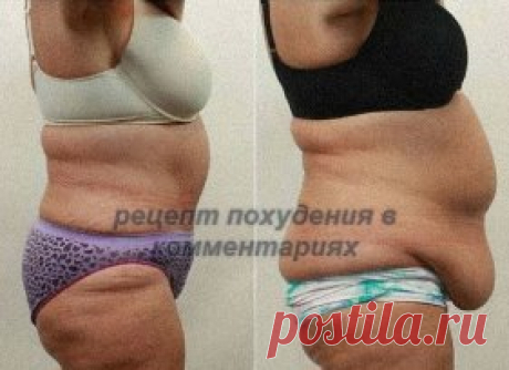 ГИМНАСТИКА ЖИВОТА ГОРЯЧИЙ ДУШ