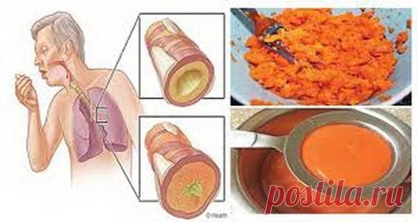 Попрощайтесь с кашлем, гриппом и очистите свои легкие с этим старым средством!