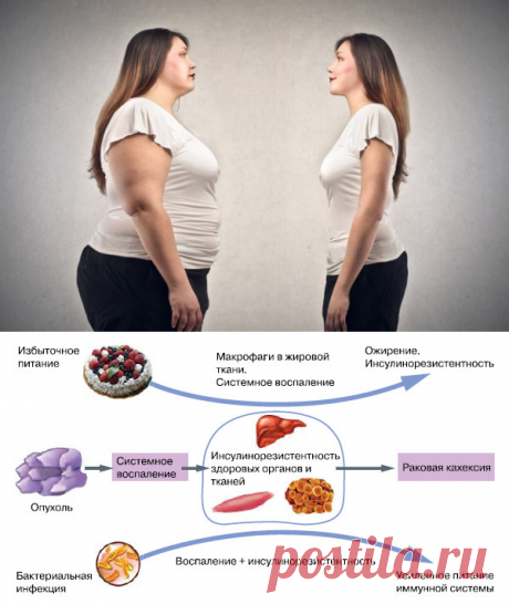 Как похудеть при повышенном инсулине в крови? — Диеты со всего света