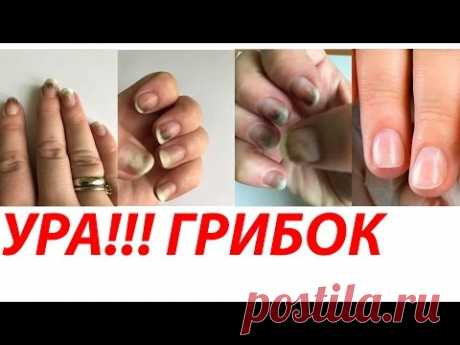 ДОКАЗАНО! ОТ ГРИБКА МОЖНО ИЗБАВИТЬСЯ ЗА 1 ДЕНЬ!!) Автор Елена Дзык