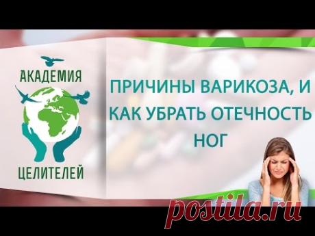 Причины варикоза, и как убрать отечность ног. ( Академия Целителей / Николай Пейчев )